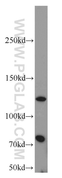 FSHR Rabbit anti-Human, Mouse, Polyclonal, Proteintech 150 &mu;L; Unconjugated:Antibodies,
