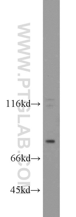 FSHR Rabbit anti-Human, Mouse, Polyclonal, Proteintech 150 &mu;L; Unconjugated:Antibodies,