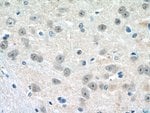Thumbnail_HES5 Rabbit anti-Human, Mouse, Rat, Polyclonal, Proteintech:Antibodies:Primary