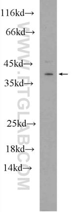 Thumbnail_HES5 Rabbit anti-Human, Mouse, Rat, Polyclonal, Proteintech:Antibodies:Primary
