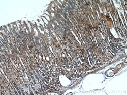 A4GNT Rabbit anti-Human, Mouse, Rat, Polyclonal, Proteintech:Antibodies:Primary