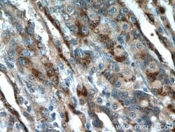 A4GNT Rabbit anti-Human, Mouse, Rat, Polyclonal, Proteintech:Antibodies:Primary