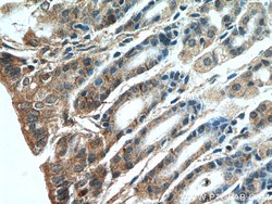 A4GNT Rabbit anti-Human, Mouse, Rat, Polyclonal, Proteintech:Antibodies:Primary