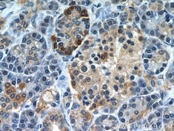 A4GNT Rabbit anti-Human, Mouse, Rat, Polyclonal, Proteintech:Antibodies:Primary