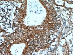 A4GNT Rabbit anti-Human, Mouse, Rat, Polyclonal, Proteintech:Antibodies:Primary