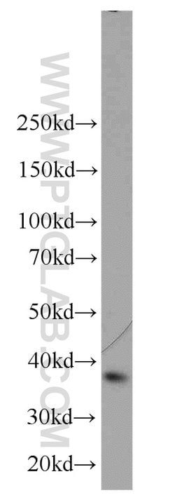 A4GNT Rabbit anti-Human, Mouse, Rat, Polyclonal, Proteintech:Antibodies:Primary