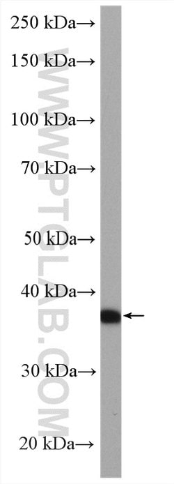 A4GNT Rabbit anti-Human, Mouse, Rat, Polyclonal, Proteintech:Antibodies:Primary