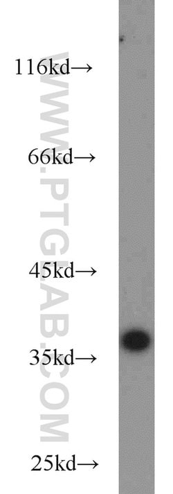 A4GNT Rabbit anti-Human, Mouse, Rat, Polyclonal, Proteintech:Antibodies:Primary