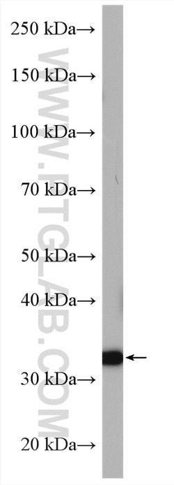 A4GNT Rabbit anti-Human, Mouse, Rat, Polyclonal, Proteintech:Antibodies:Primary