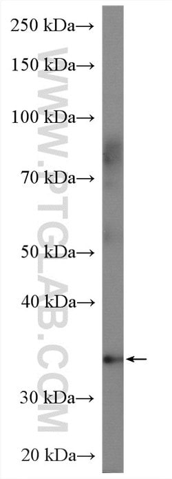A4GNT Rabbit anti-Human, Mouse, Rat, Polyclonal, Proteintech:Antibodies:Primary