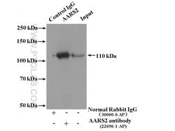 AARS2 Rabbit anti-Human, Polyclonal, Proteintech 20 &mu;L | Buy Online | Proteintech | Fisher Scientific
