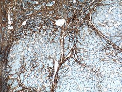 Collagen Type III (N-terminal) Rabbit anti-Human, Mouse, Rat, Polyclonal,