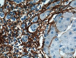 Collagen Type III (N-terminal) Rabbit anti-Human, Mouse, Rat, Polyclonal,