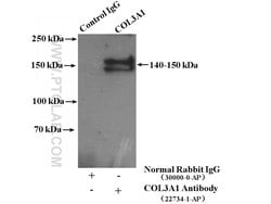 Collagen Type III (N-terminal) Rabbit anti-Human, Mouse, Rat, Polyclonal,