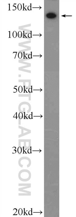 Collagen Type III (N-terminal) Rabbit anti-Human, Mouse, Rat, Polyclonal,