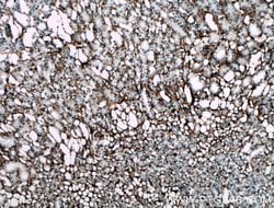 Collagen Type III (N-terminal) Rabbit anti-Human, Mouse, Rat, Polyclonal,