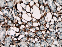 Collagen Type III (N-terminal) Rabbit anti-Human, Mouse, Rat, Polyclonal,