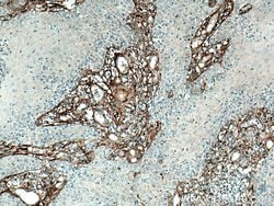 Collagen Type III (N-terminal) Rabbit anti-Human, Mouse, Rat, Polyclonal,