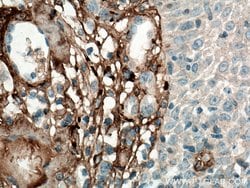 Collagen Type III (N-terminal) Rabbit anti-Human, Mouse, Rat, Polyclonal,
