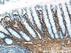Collagen Type III (N-terminal) Rabbit anti-Human, Mouse, Rat, Polyclonal,