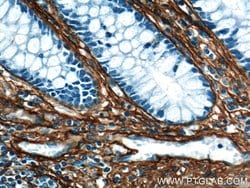 Collagen Type III (N-terminal) Rabbit anti-Human, Mouse, Rat, Polyclonal,