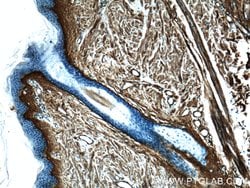 Collagen Type III (N-terminal) Rabbit anti-Human, Mouse, Rat, Polyclonal,