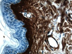 Collagen Type III (N-terminal) Rabbit anti-Human, Mouse, Rat, Polyclonal,
