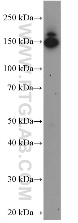 Collagen Type III (N-terminal) Rabbit anti-Human, Mouse, Rat, Polyclonal,