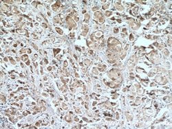 IL22RA2 Rabbit anti-Human, Polyclonal, Proteintech 150 &mu;L | Buy Online | Proteintech Group Inc | Fisher Scientific