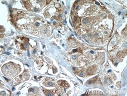 IL22RA2 Rabbit anti-Human, Polyclonal, Proteintech 150 &mu;L | Buy Online | Proteintech Group Inc | Fisher Scientific
