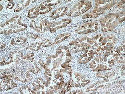 IL22RA2 Rabbit anti-Human, Polyclonal, Proteintech 150 &mu;L | Buy Online | Proteintech Group Inc | Fisher Scientific