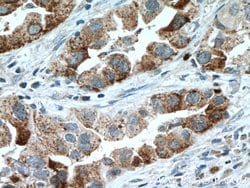 IL22RA2 Rabbit anti-Human, Polyclonal, Proteintech 150 &mu;L | Buy Online | Proteintech Group Inc | Fisher Scientific
