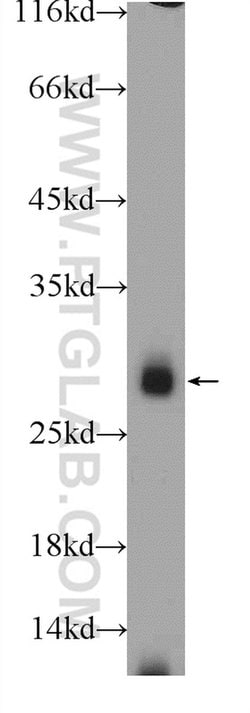 IL22RA2 Rabbit anti-Human, Polyclonal, Proteintech 150 &mu;L | Buy Online | Proteintech Group Inc | Fisher Scientific