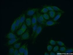 MEX3C Rabbit anti-Human, Mouse, Polyclonal, Proteintech 150 &mu;L; Unconjugated:Antibodies,
