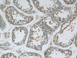 MEX3C Rabbit anti-Human, Mouse, Polyclonal, Proteintech 150 &mu;L; Unconjugated:Antibodies,