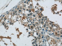 MEX3C Rabbit anti-Human, Mouse, Polyclonal, Proteintech 150 &mu;L; Unconjugated:Antibodies,
