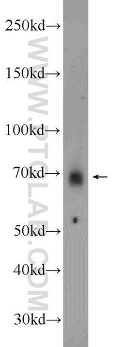 MEX3C Rabbit anti-Human, Mouse, Polyclonal, Proteintech 150 &mu;L; Unconjugated:Antibodies,