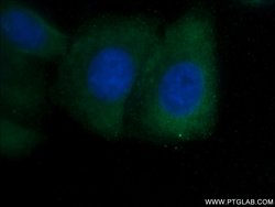 SHE Rabbit anti-Human, Mouse, Polyclonal, Proteintech 20 &mu;L; Unconjugated:Antibodies,