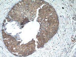 SHE Rabbit anti-Human, Mouse, Polyclonal, Proteintech 20 &mu;L; Unconjugated:Antibodies,