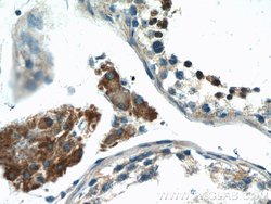 SHE Rabbit anti-Human, Mouse, Polyclonal, Proteintech 20 &mu;L; Unconjugated:Antibodies,