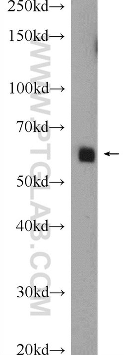 SHE Rabbit anti-Human, Mouse, Polyclonal, Proteintech 20 &mu;L; Unconjugated:Antibodies,
