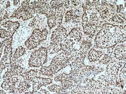 PARP1 Rabbit anti-Human, Mouse, Polyclonal, Proteintech 20 &mu;L; Unconjugated:Antibodies,