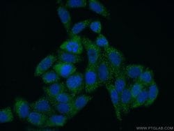 SCP2 Rabbit anti-Human, Mouse, Polyclonal, Proteintech 150 &mu;L; Unconjugated:Antibodies,