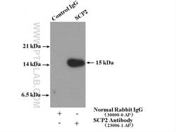 SCP2 Rabbit anti-Human, Mouse, Polyclonal, Proteintech 150 &mu;L; Unconjugated:Antibodies,