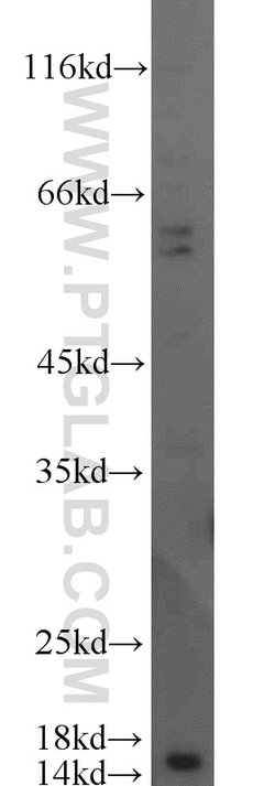 SCP2 Rabbit anti-Human, Mouse, Polyclonal, Proteintech 150 &mu;L; Unconjugated:Antibodies,