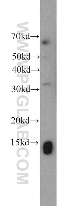 SCP2 Rabbit anti-Human, Mouse, Polyclonal, Proteintech 150 &mu;L; Unconjugated:Antibodies,