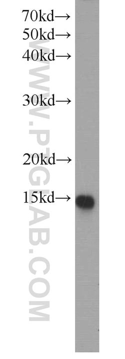 SCP2 Rabbit anti-Human, Mouse, Polyclonal, Proteintech 150 &mu;L; Unconjugated:Antibodies,