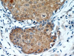 Oxytocin Receptor Rabbit anti-Human, Polyclonal, Proteintech:Antibodies:Primary