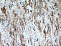 Oxytocin Receptor Rabbit anti-Human, Polyclonal, Proteintech:Antibodies:Primary