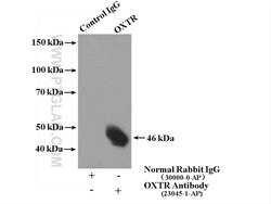 Oxytocin Receptor Rabbit anti-Human, Polyclonal, Proteintech:Antibodies:Primary